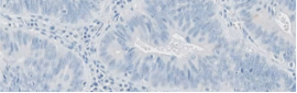 Tissue sample showing no staining (0)