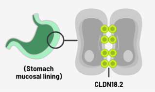 Diagram showing normal gastric mucosa and CLDN18.2 confined within cellular tight junctions