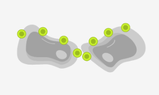 Diagram showing retention and exposure of CLDN18.2 during malignant transformation, making it accessible to antibodies